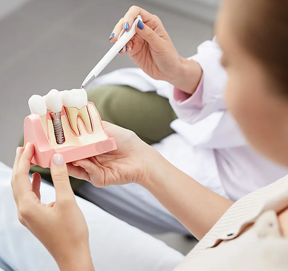 Everything You Need to Know About Dental Implants