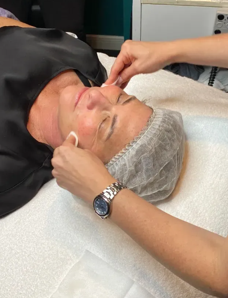 The Ultimate Guide to Medi Peels for Radiant Skin